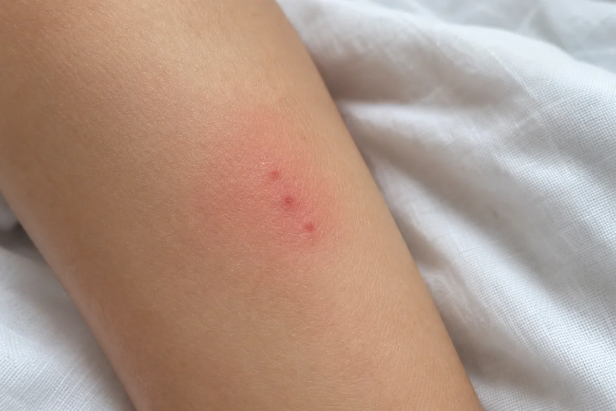puces ou punaises de lit
